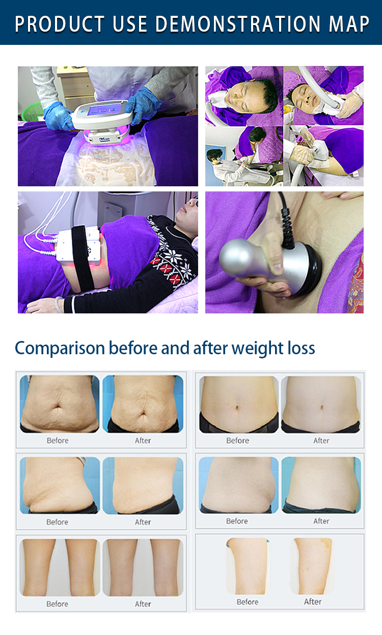 1689068162591284.jpg CRYO80详情图-08.jpg